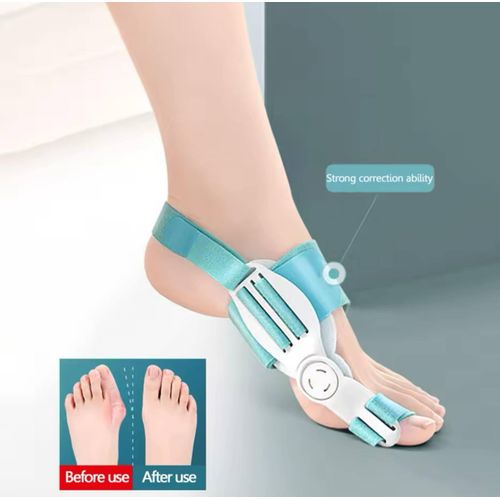 FEETIFIX مصحح لأصابع القدم