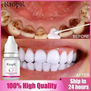 Blanchisseur de dents RtopR مبيض الأسنان